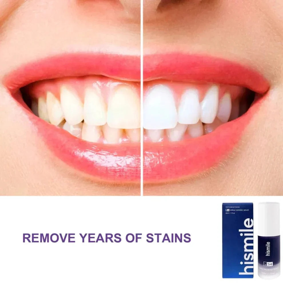 ✨ HiSmile V34 Purple Teeth Whitening Serum – Instant Stain Removal & Brighter Smile 💜😊