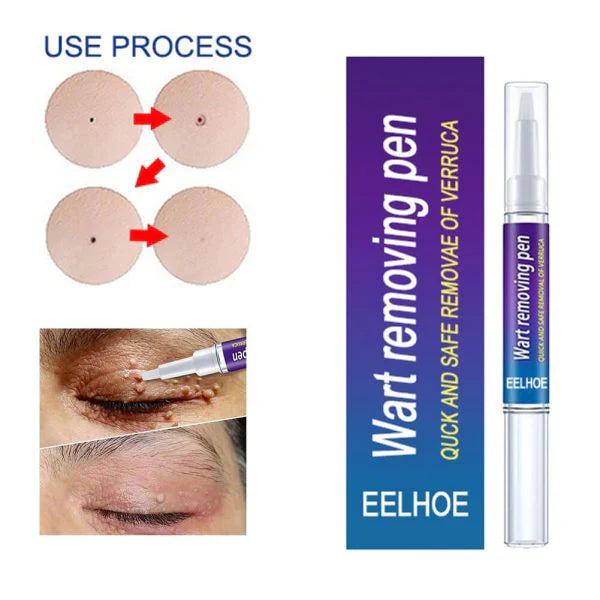 ✨ HiSmile V34 Purple Teeth Whitening Serum – Instant Stain Removal & Brighter Smile 💜😊