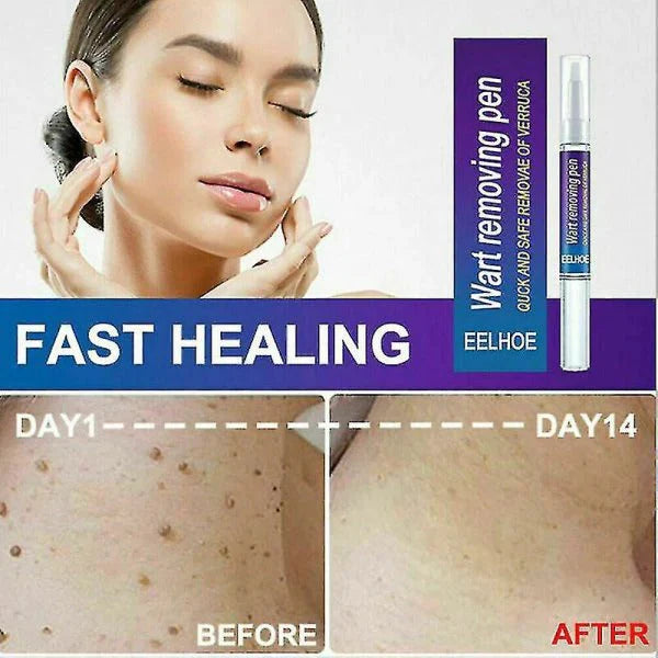 ✨ HiSmile V34 Purple Teeth Whitening Serum – Instant Stain Removal & Brighter Smile 💜😊