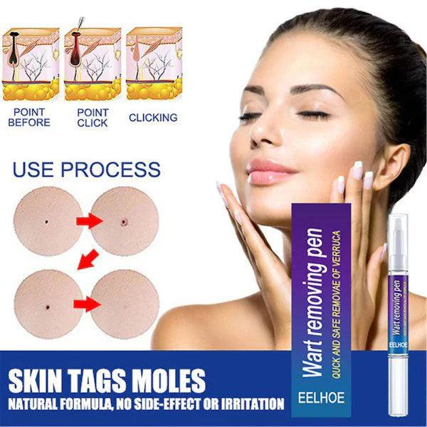 ✨ HiSmile V34 Purple Teeth Whitening Serum – Instant Stain Removal & Brighter Smile 💜😊